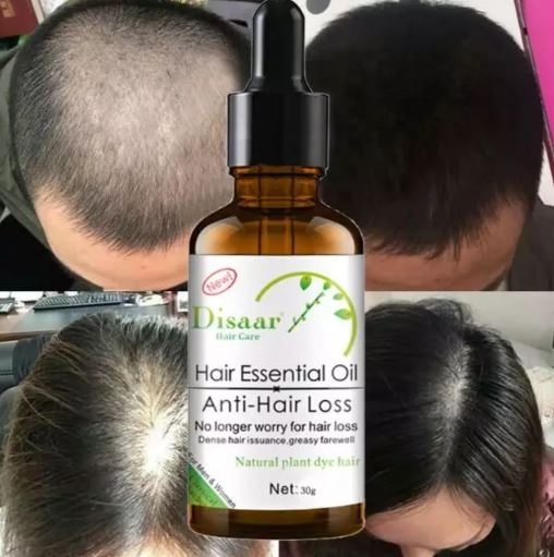 DISAAR HAIR ACEITE ESENCIAL ANTI CAÍDA